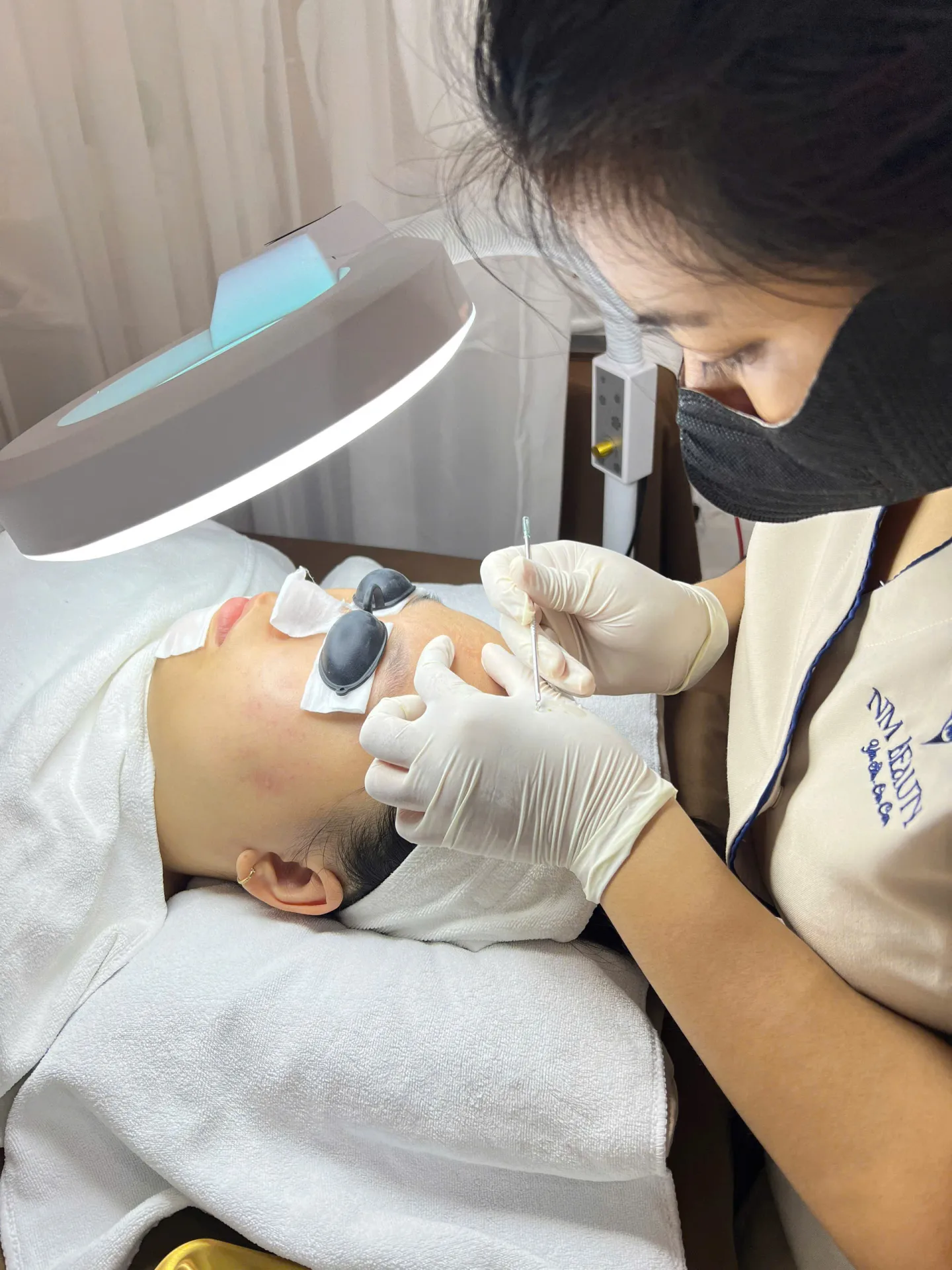 Combo Nặn Mụn + Bắn IPL