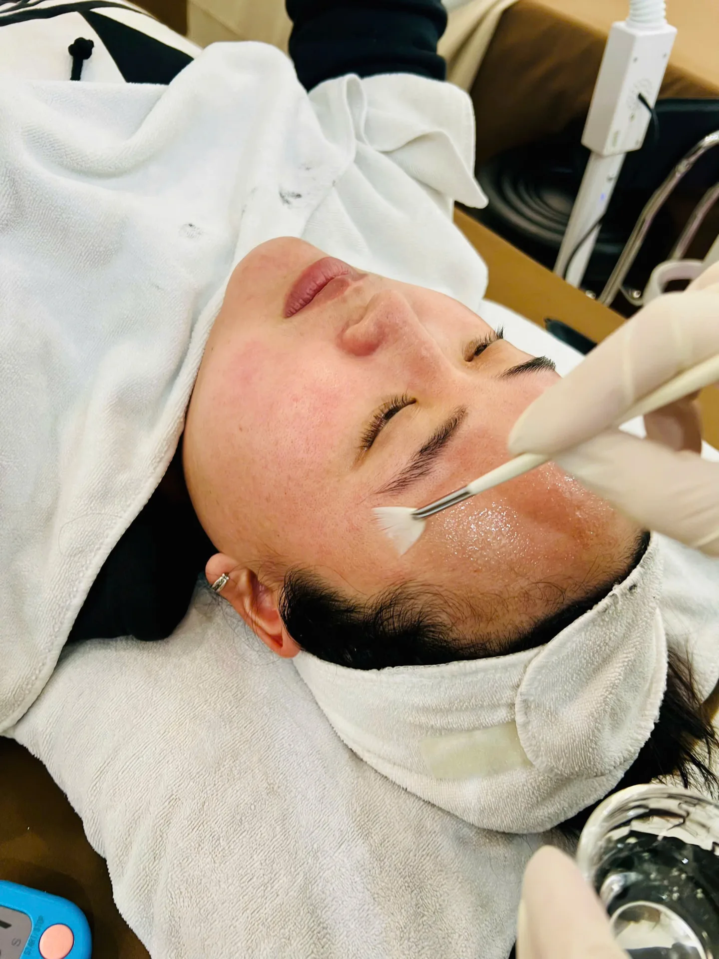Layer Peel (Peel Chồng Peel)
