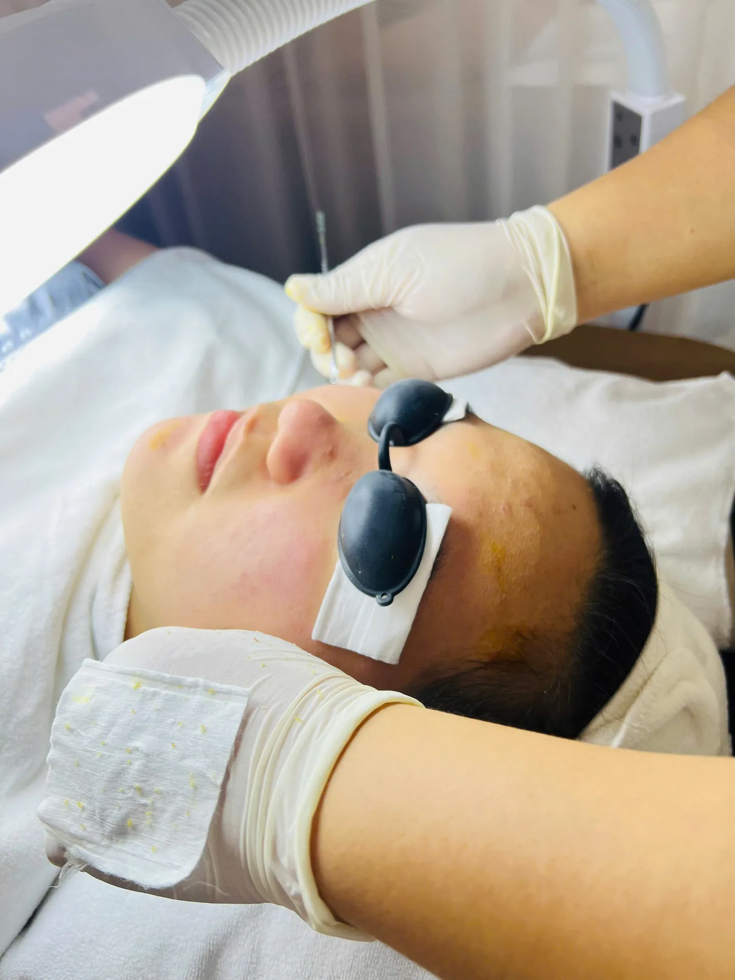 Nặn Mụn Tiêu Khuẩn Icon Skin