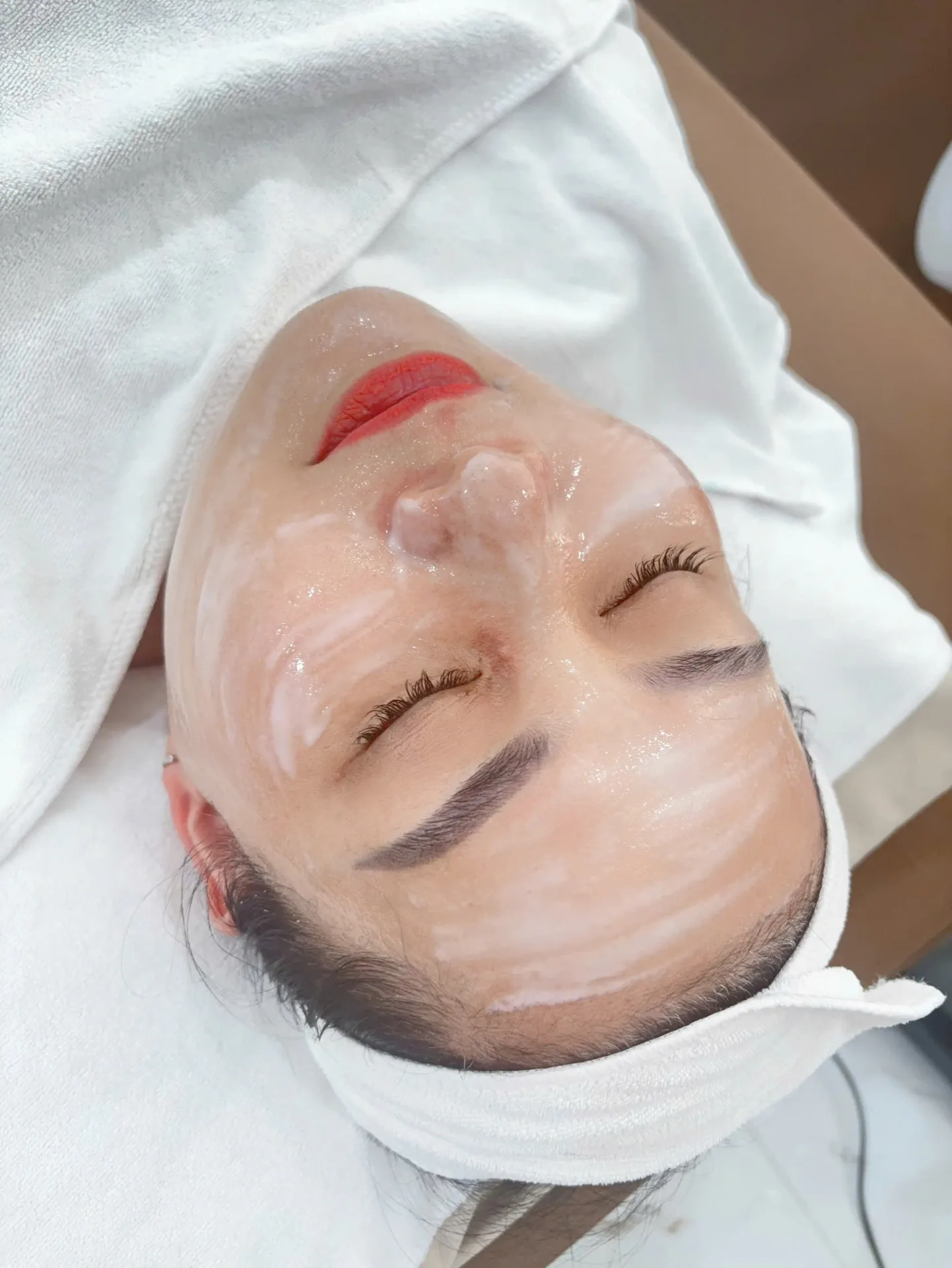 Peel Phục Hồi (Không Bong)
