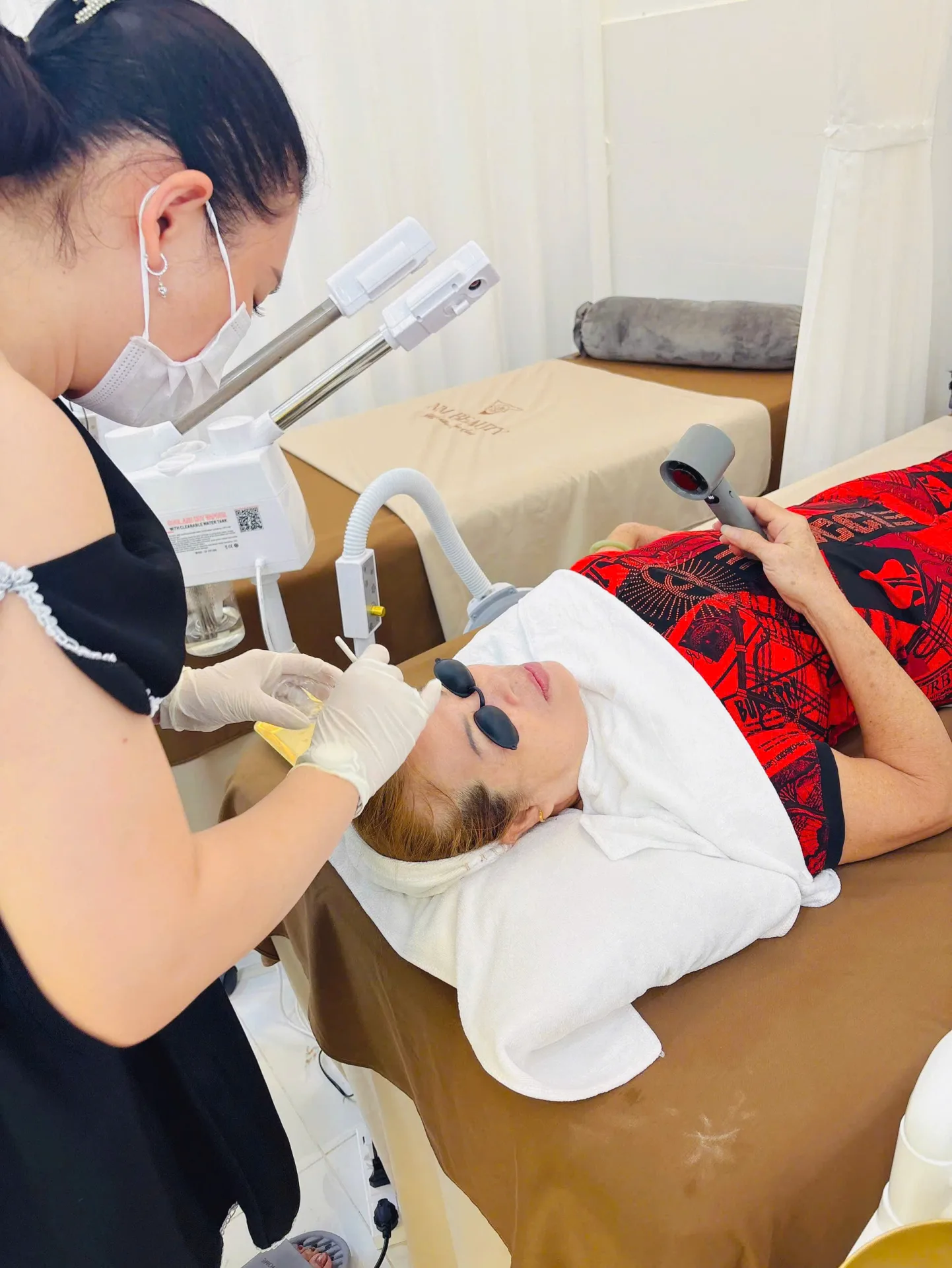 Peel Tàn Nhang + Chấm TCA