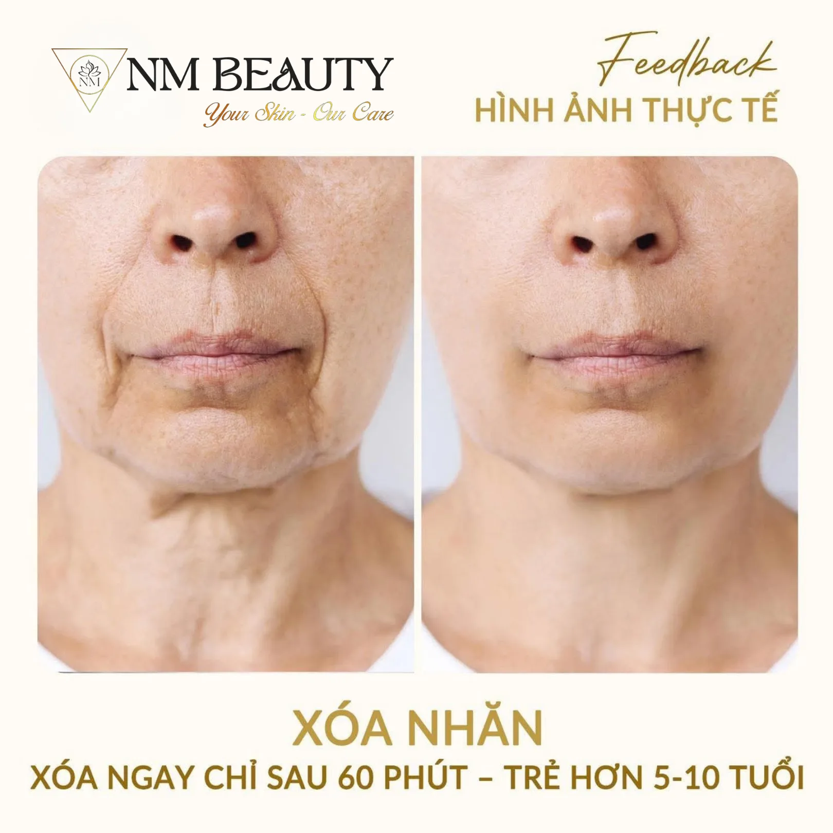 Khách hàng trước & sau